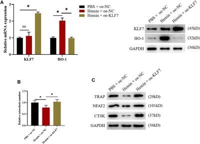 Transcription Factor KLF7 Promotes Osteoclast Differentiation by Suppressing HO-1